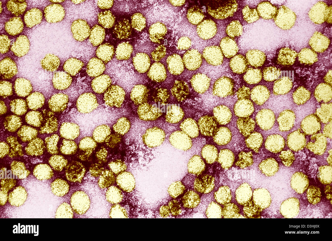 YELLOW FEVER VIRUS Stock Photo - Alamy