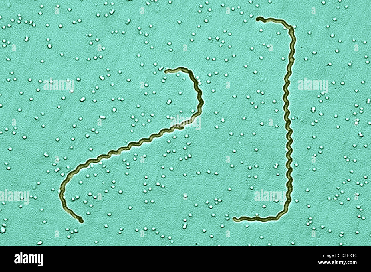 LEPTOSPIRA INTERROGANS, SEM Stock Photo Alamy