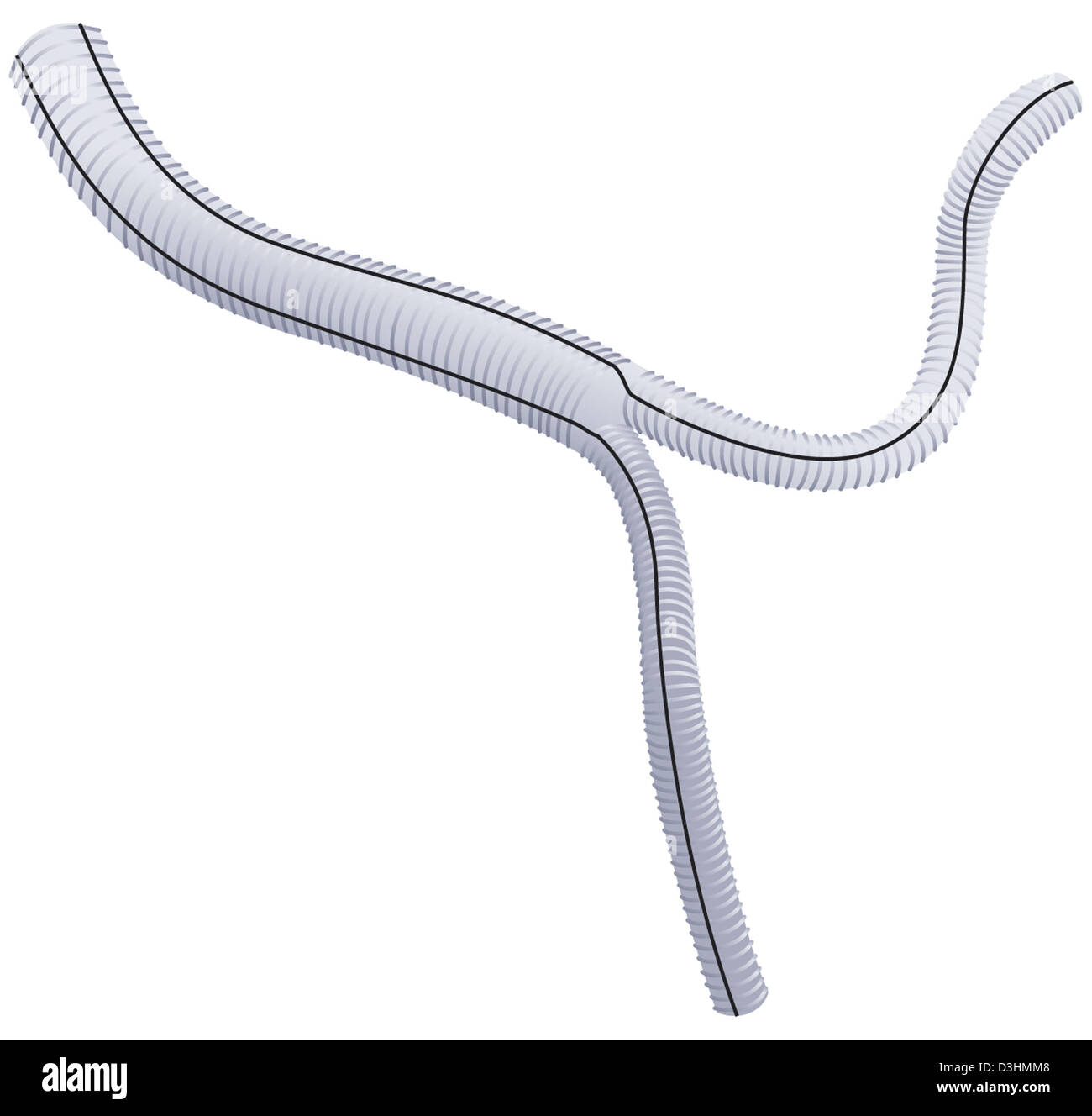 Prostheses Vascular  . Vascular Prosthetic Implants Are Prone To Failure, Resulting In Significant Morbidity, Cost, Discomfort, And Inconvenience For The Patient.
