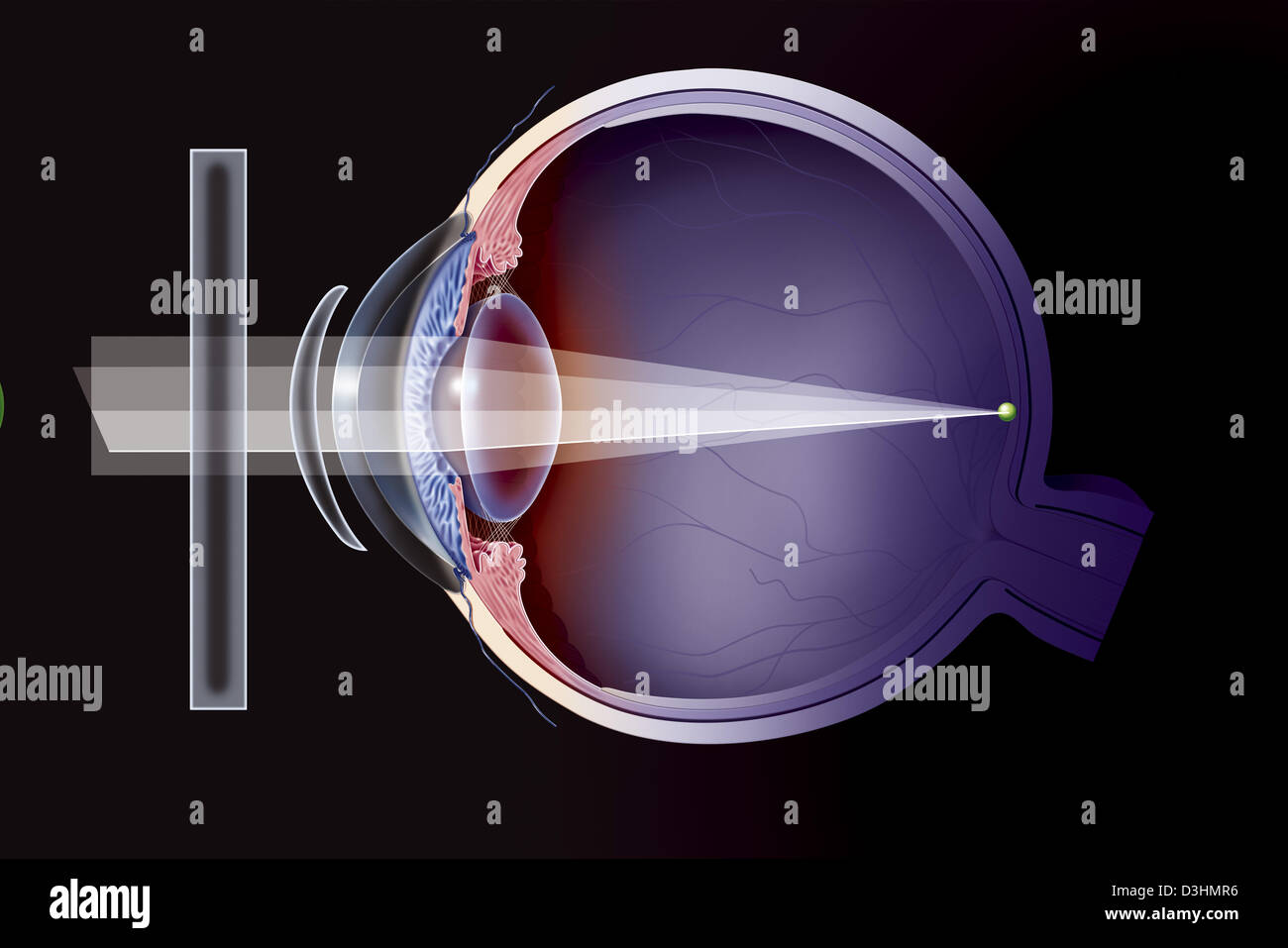 ASTIGMATISM, DRAWING Stock Photo