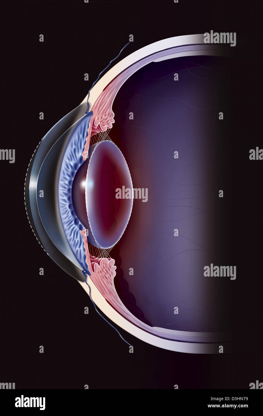 ASTIGMATISM, DRAWING Stock Photo