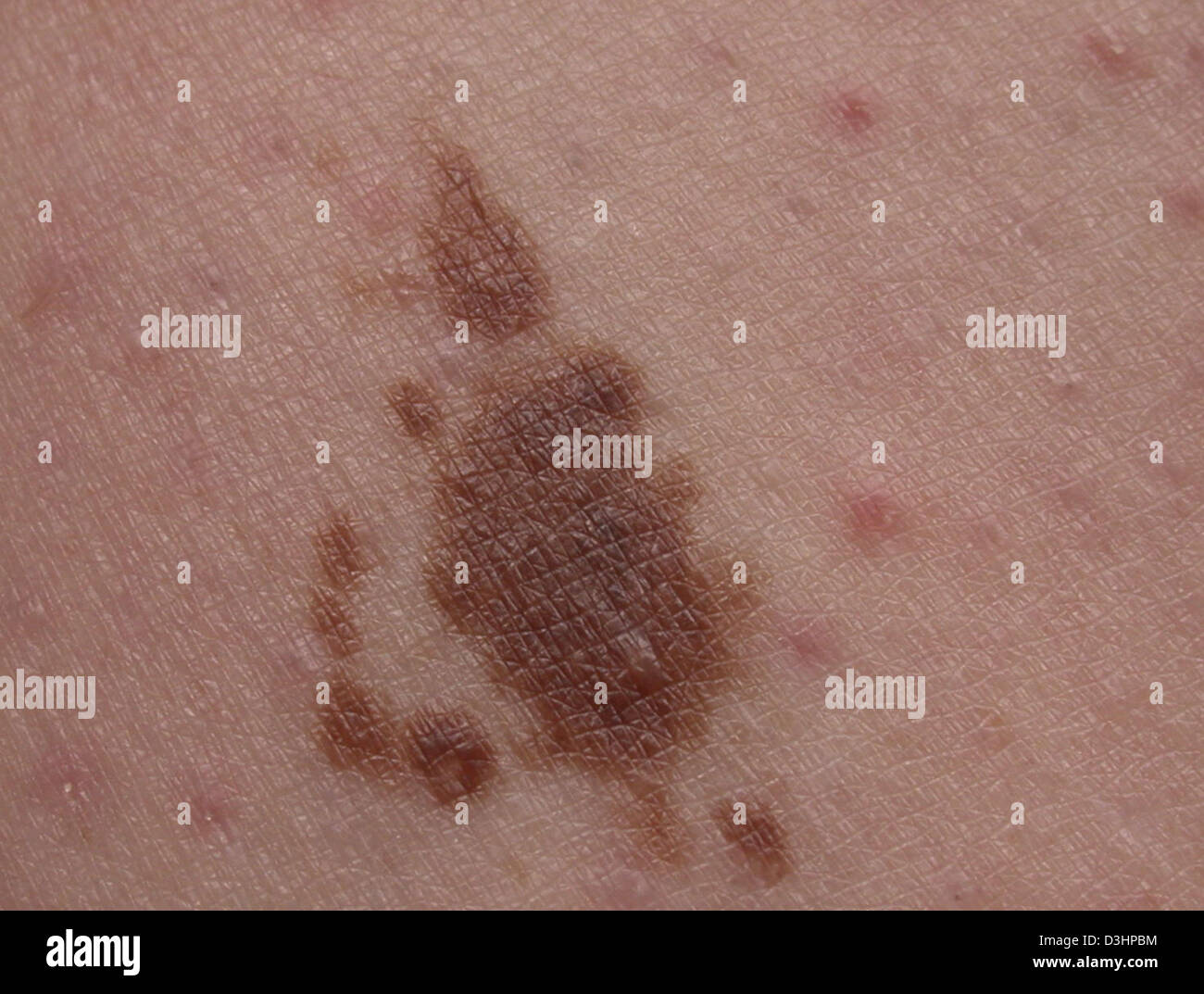 Cafe au lait skin pigmentation hi-res stock photography and images - Alamy