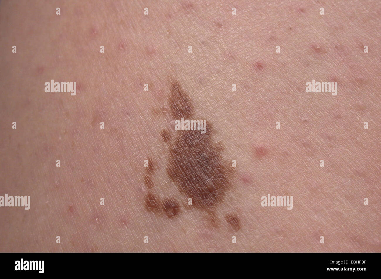 Cafe au lait skin pigmentation hi-res stock photography and images - Alamy