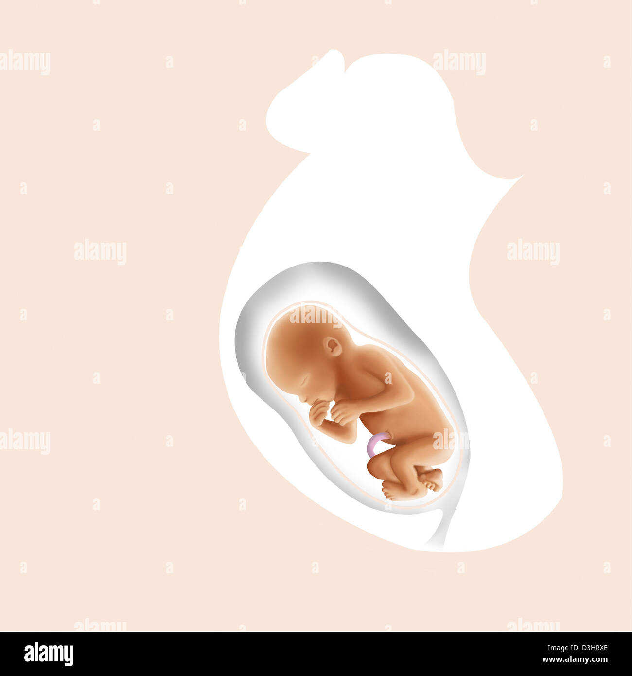 FETAL BREECH PRESENTATION Stock Photo