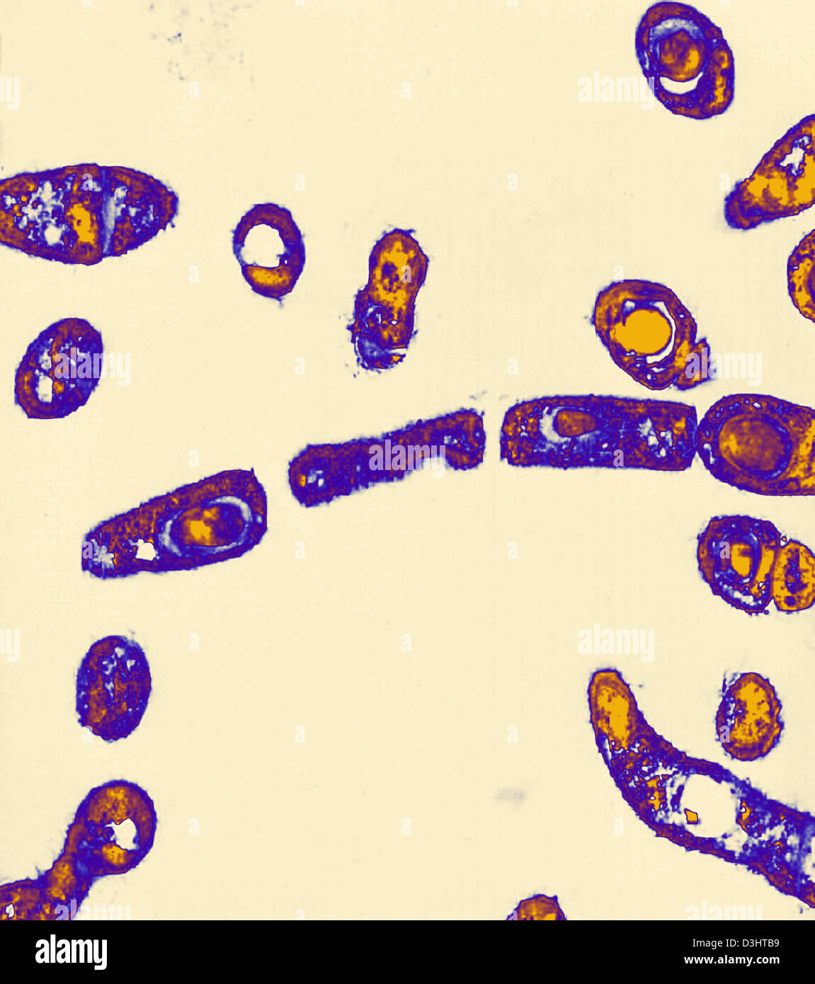 ANTHRAX BACTERIUM, TEM Stock Photo