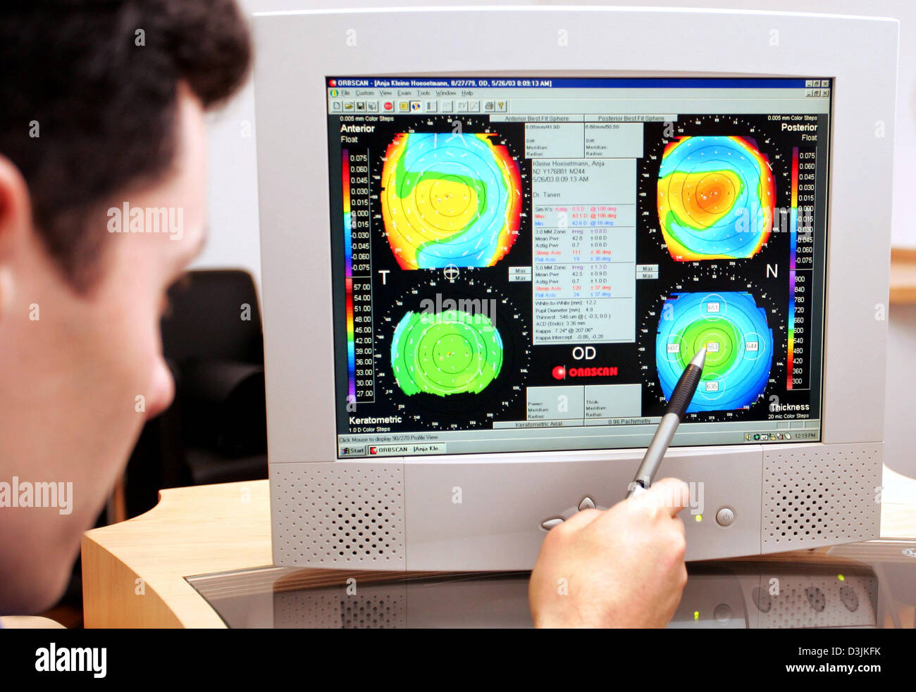 (dpa) - Doctor med Suphi Taneri points at the scanning data of an eye of a patient in preparation for LASIK eye surgery at the Hohenzollernklinik - Centre for refractive surgery in Muenster, Germany, 27 January 2005. LASIK stands for 'Laser-Assisted In Situ Keratomileusis' and refers to a surgical procedure on the eye with an excimer laser intended to reduce a person's dependency o Stock Photo