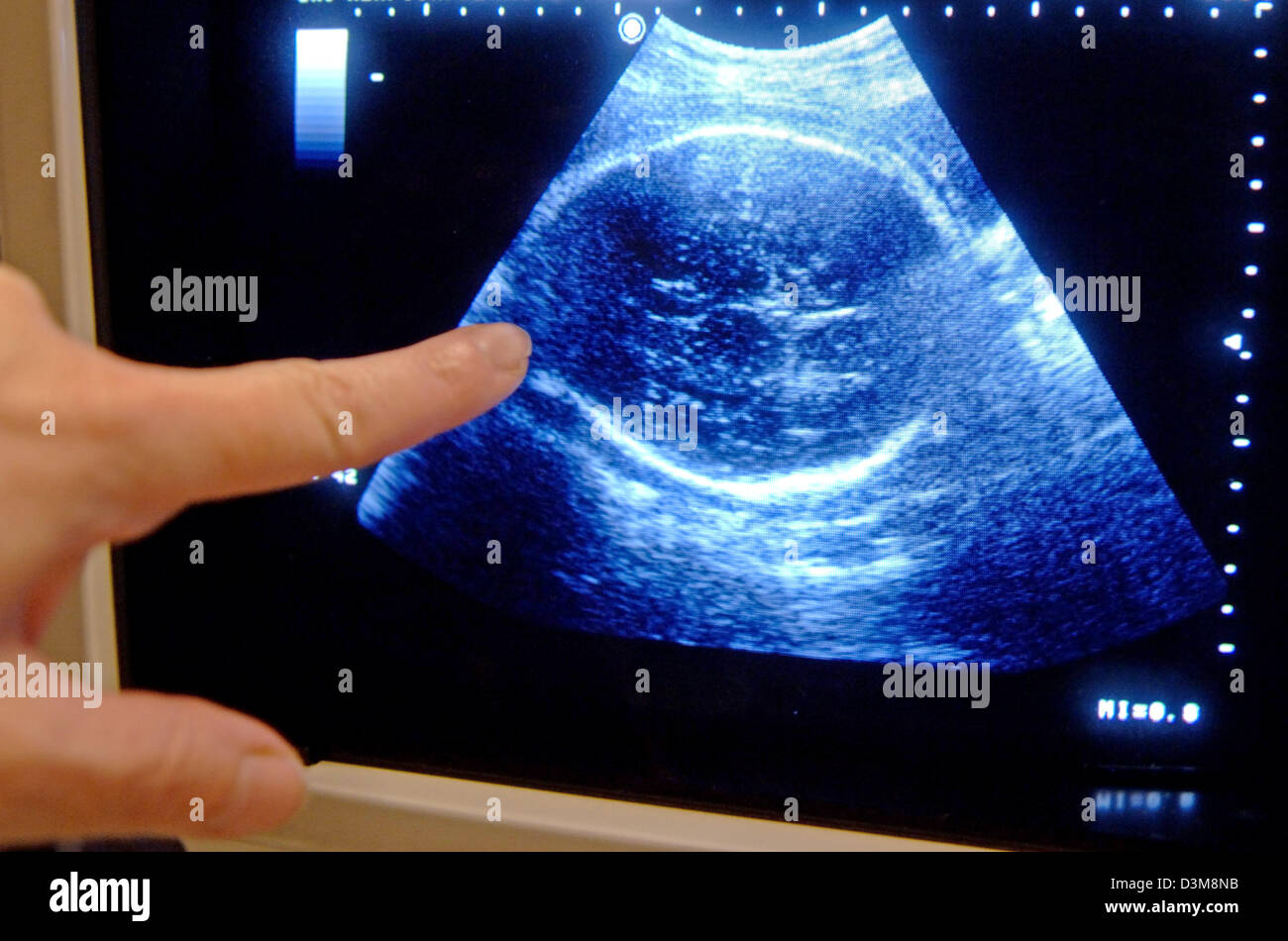 (dpa) - A hand shows the unborn child on a subsonic picture in a surgery in Straubing, Germany, 21 December 2005. Photo: Armin Weigel Stock Photo