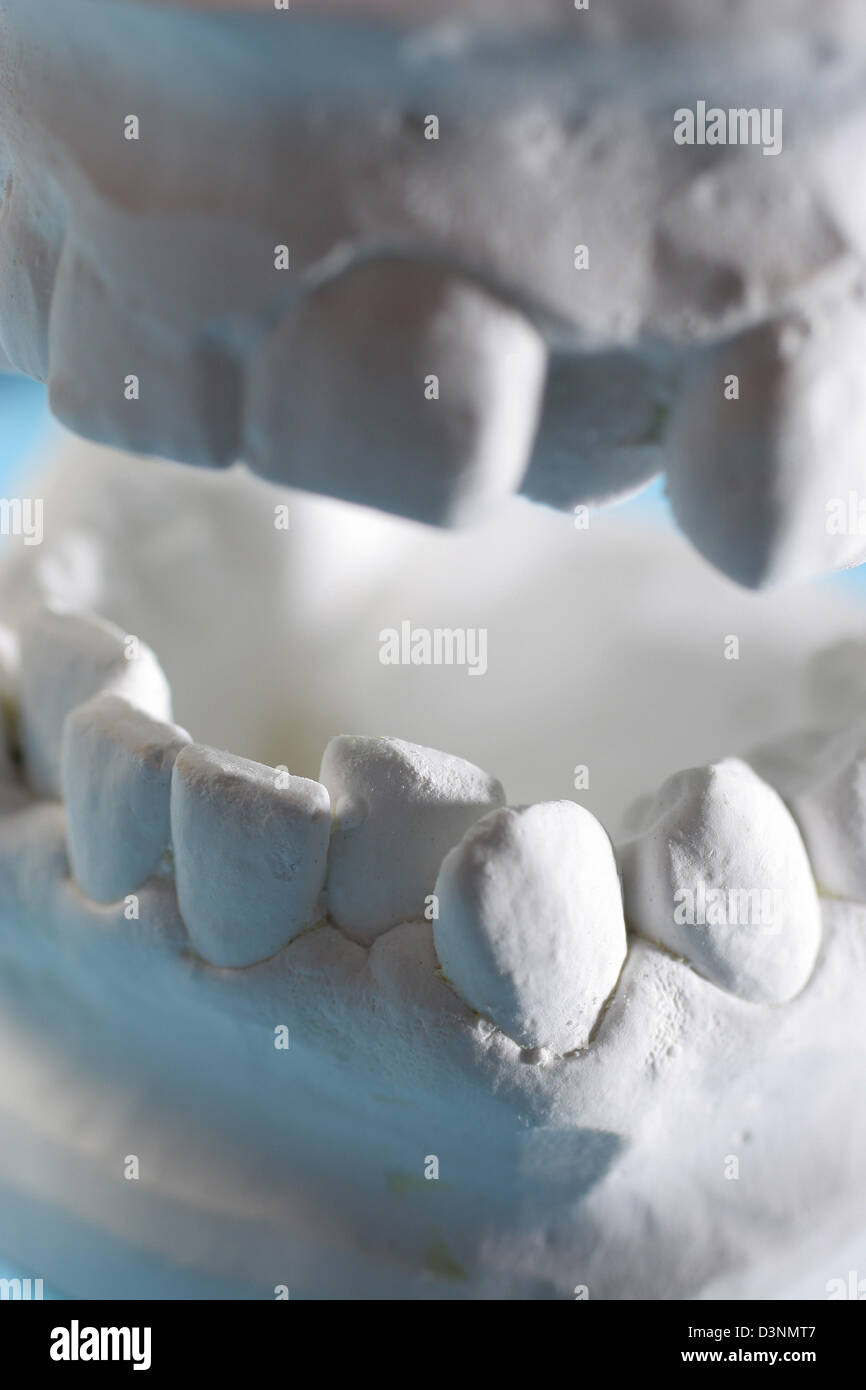 The picture shows a close up of a denture plaster model in Frankfurt