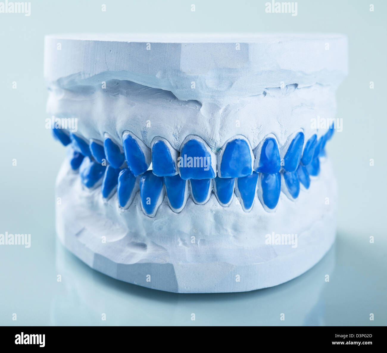 individual plaster dental molds to make trays Stock Photo