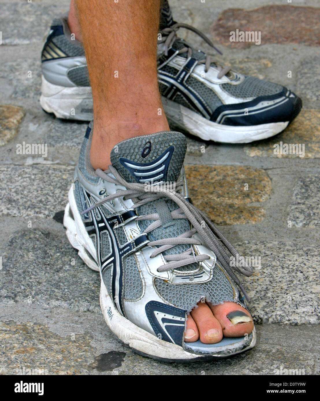 (dpa file) - The feet of German extreme runner Ronald Prokein pictured after his 5,000 kilometres from Istanbul, Turkey to Nordkap, Norway in Rostock, Germany, 25 August 2006. Prokein started on 20 May 2006 through Turkey, Bulgaria, Serbia, Hungaria, Austria, Czech Republic, Germany, Denmark, Sweden, Finland and arrived in Norway on 21 August. He made 60 to 110 kilometres per day.  Stock Photo