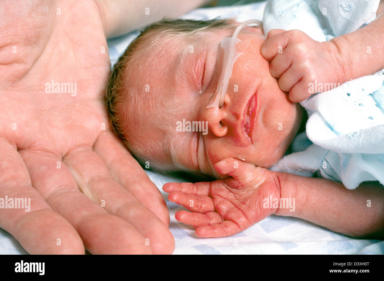 Premature baby with a feeding tube in an incubator Stock Photo
