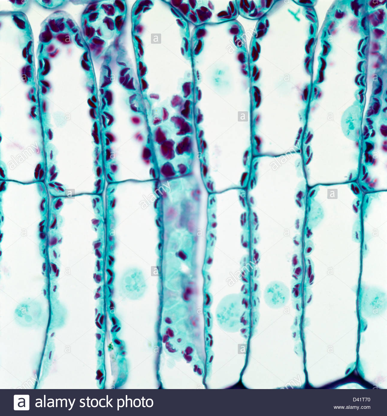 Palisade Cell Under Microscope ILOC