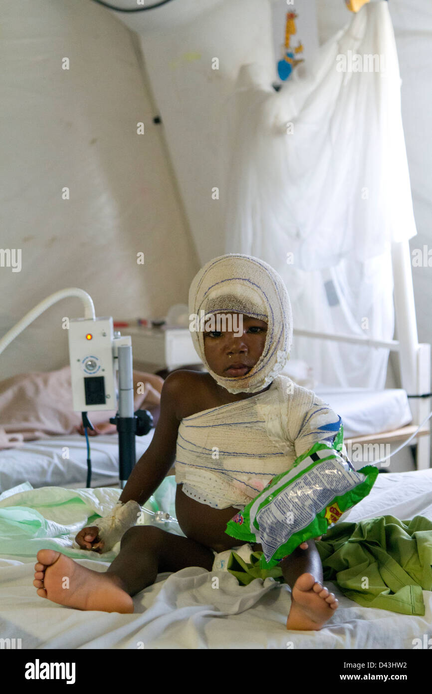 burn unit in Drouillard Hospital MSF PortauPrince Haiti Stock Photo Alamy