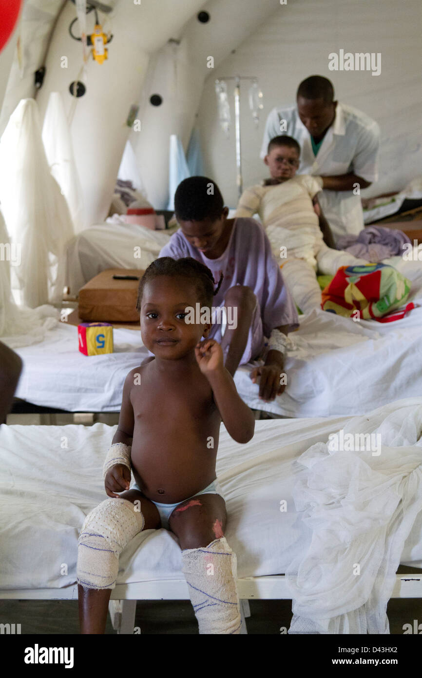 children playing with balloon in the burn unit in Drouillard Hospital