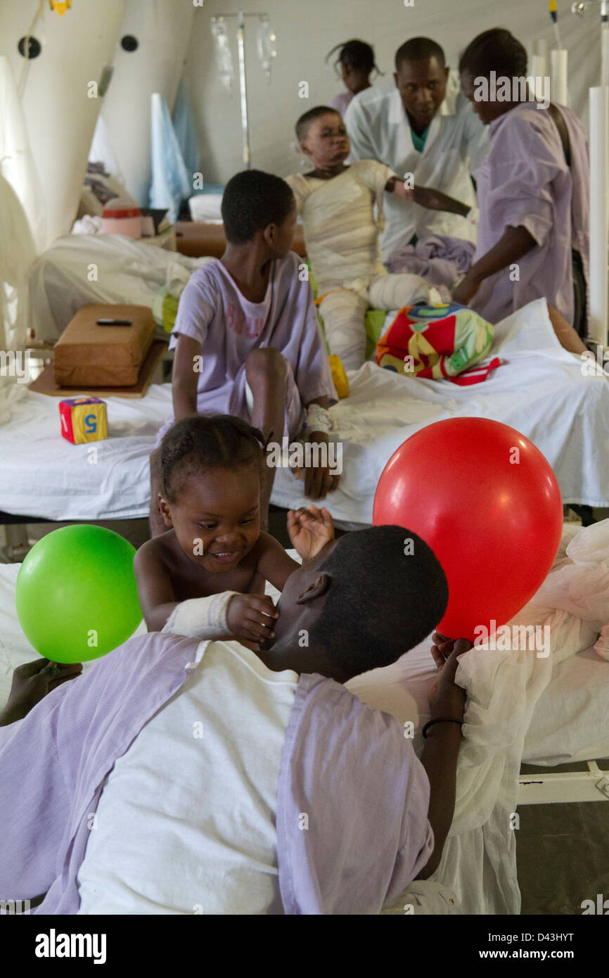 children playing with balloon in the burn unit in Drouillard Hospital