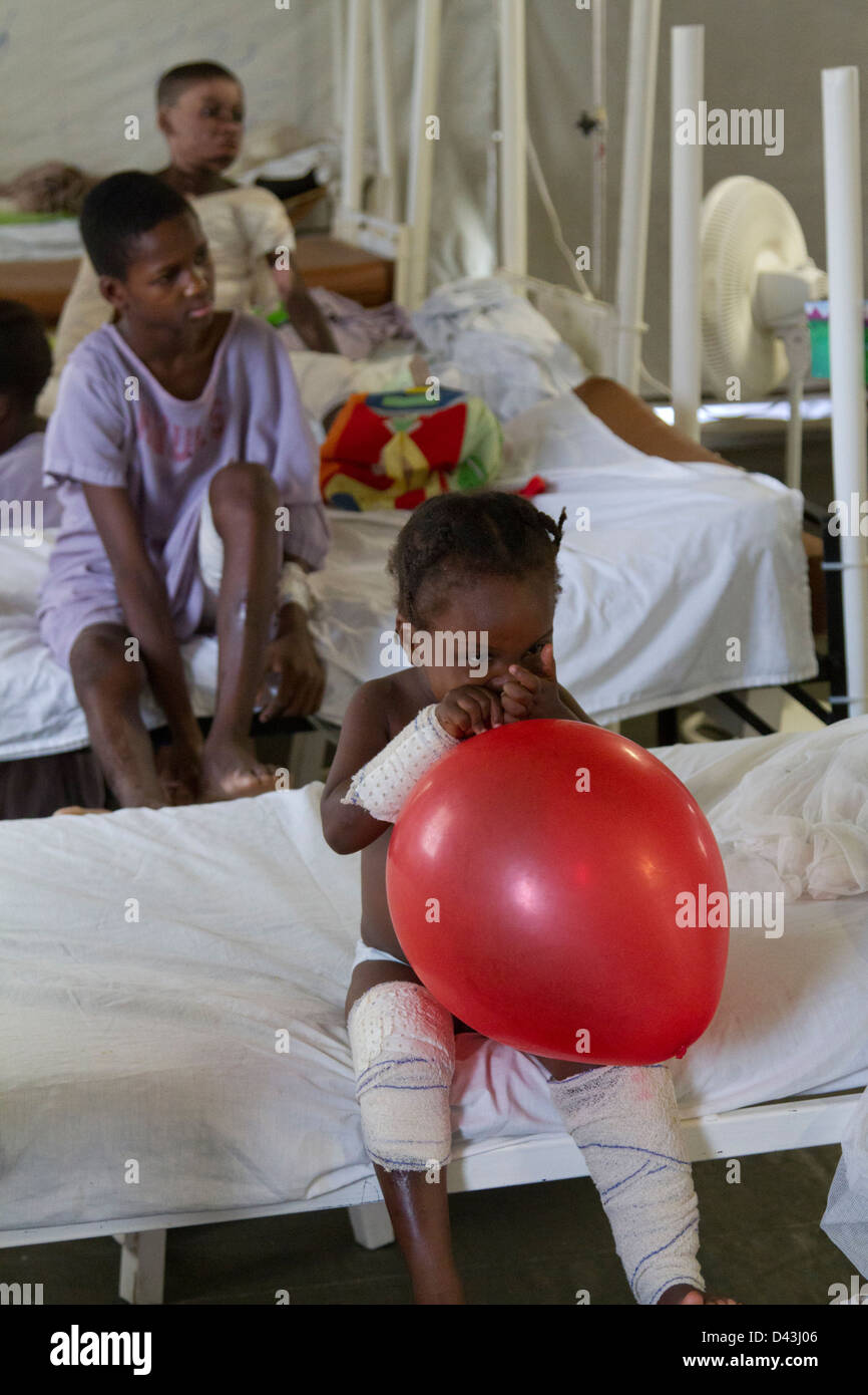 children playing with balloon in the burn unit in Drouillard Hospital