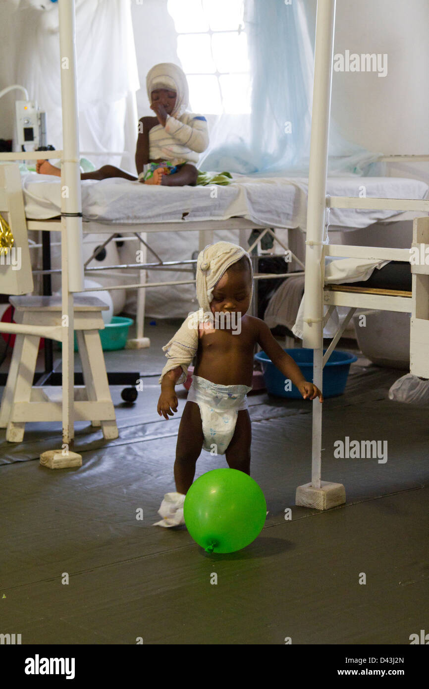 children playing with balloon in the burn unit in Drouillard Hospital