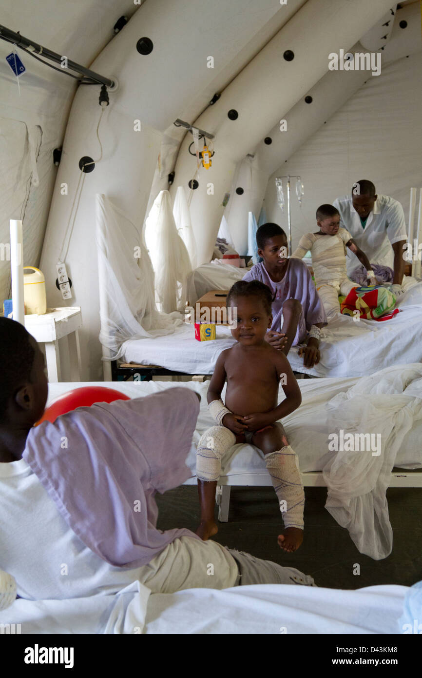 children playing with balloon in the burn unit in Drouillard Hospital