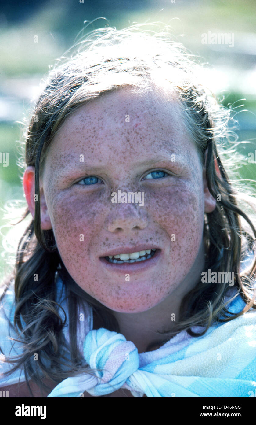 Freckles cover the face of a young German girl who spends summers in the sun on her farm near Hinterzarten in the Black Forest (Schwarzwald), Germany. Stock Photo