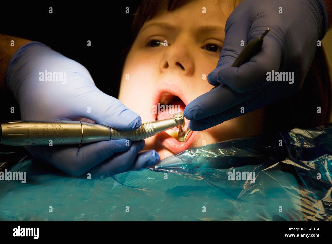 A girl undergoing treatment at the dentist's office;Whitley bay tyne