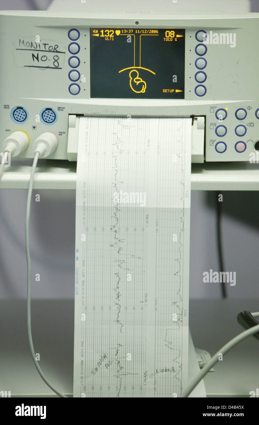 Baby heart rate monitor and printout Stock Photo Alamy