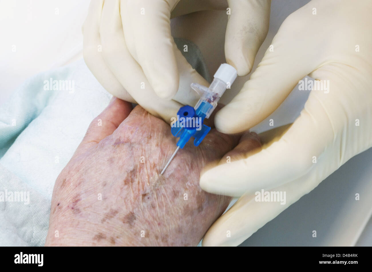 Hand of nurse inserting intravenous catheter into patients hand Stock