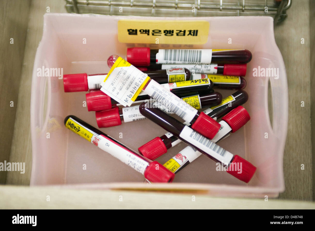 Patients blood is bottled and labeled prior to be investigated to determine blood type Stock Photo
