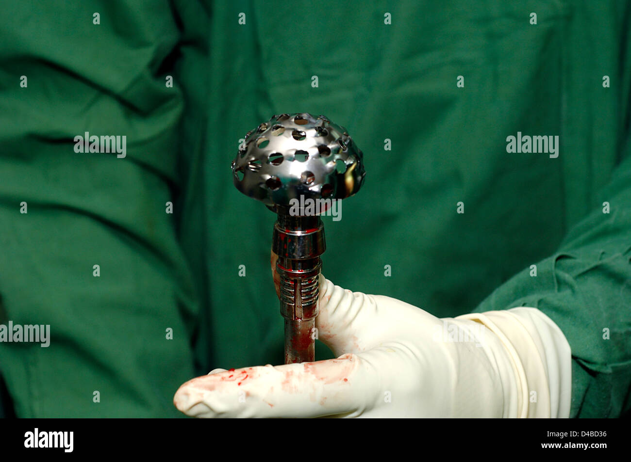 Human hip operation hires stock photography and images Alamy