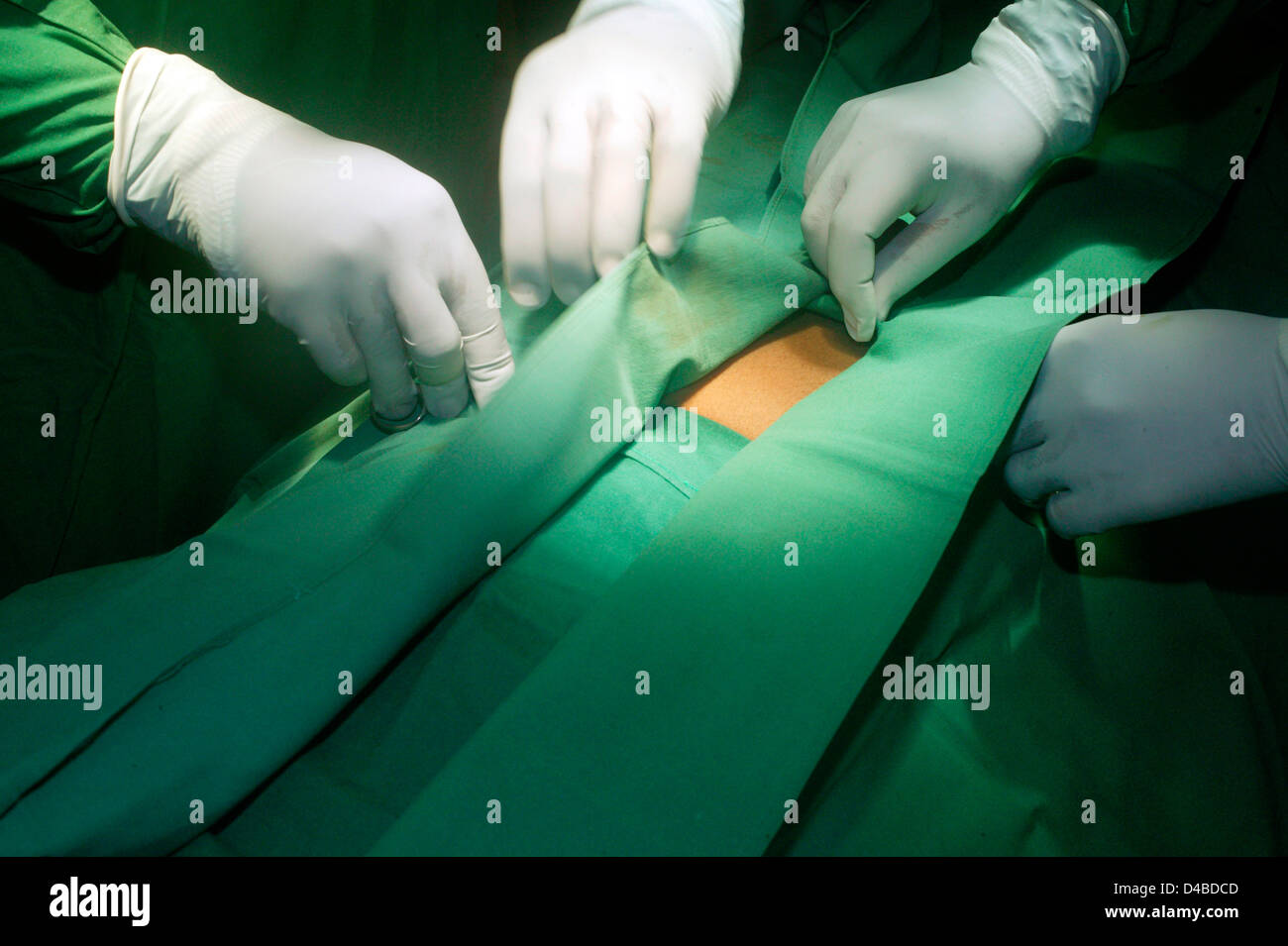 The abdominal region is being cleansed with an iodinebased antiseptic