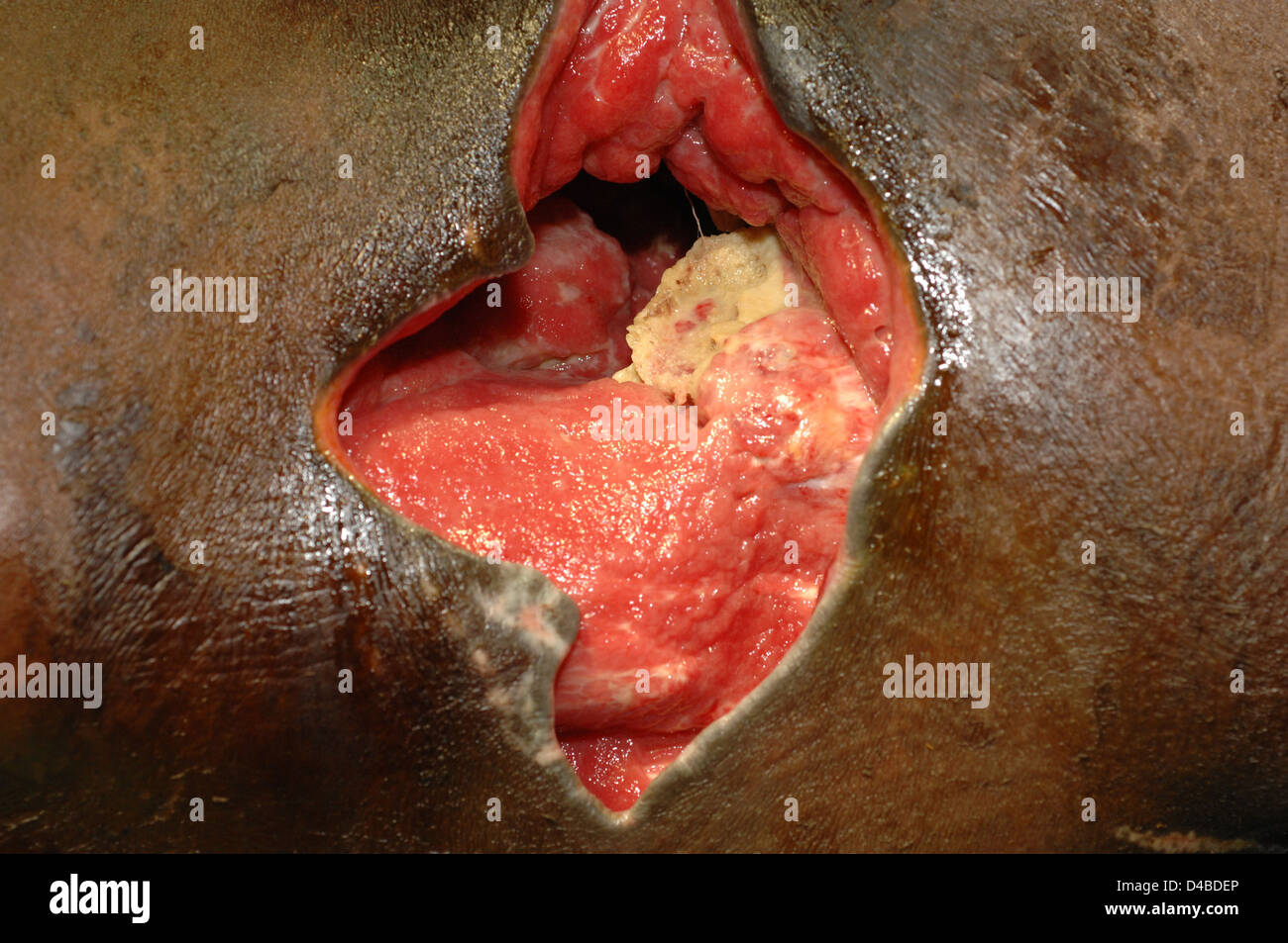 Close-up of gunshot wound to lower back Stock Photo