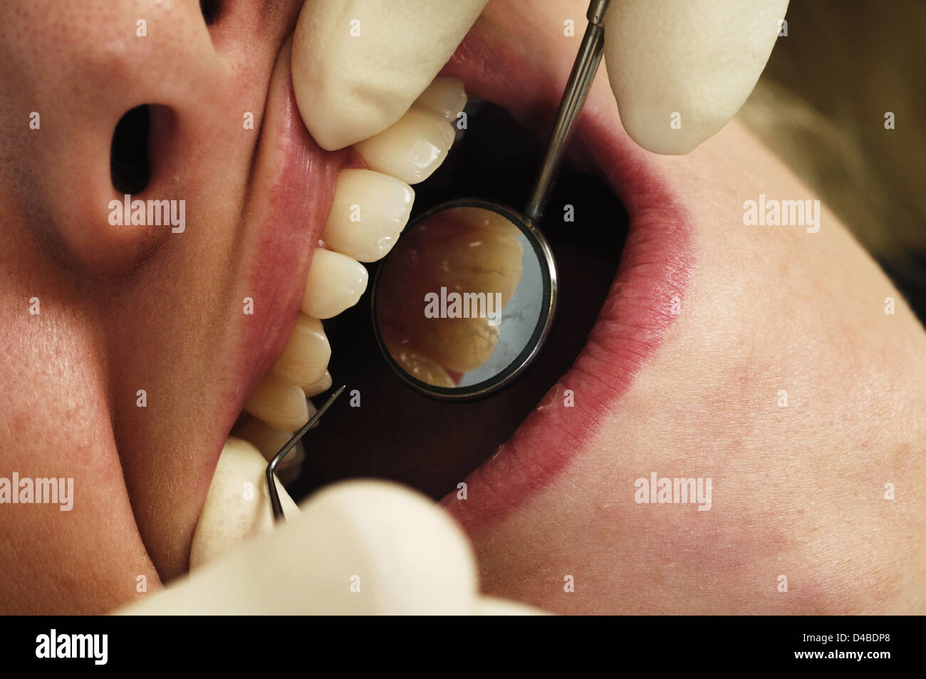 Dentist giving women soft tissue dental examination Stock Photo Alamy