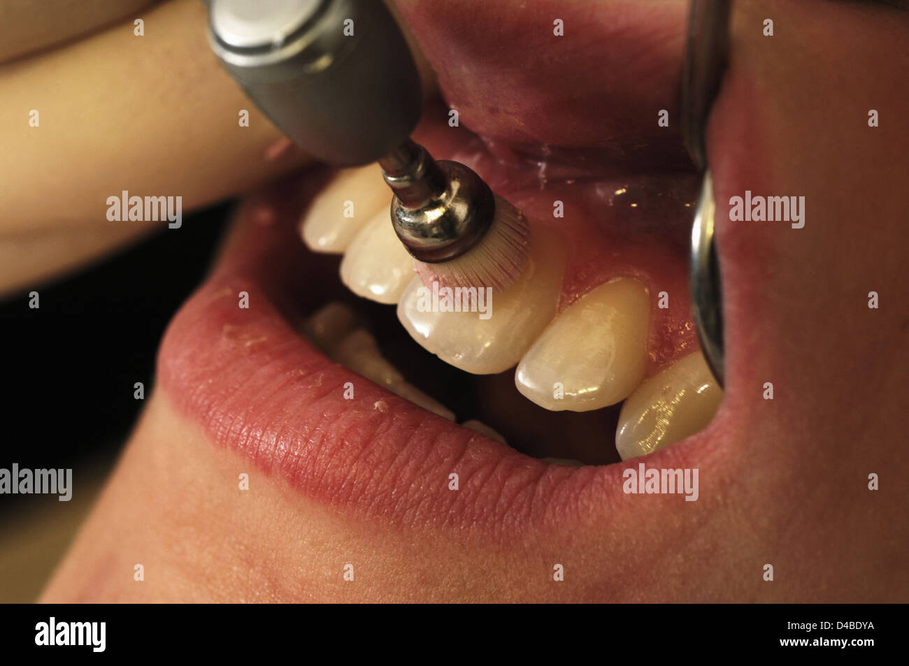 Dentist polishing womens teeth Stock Photo Alamy