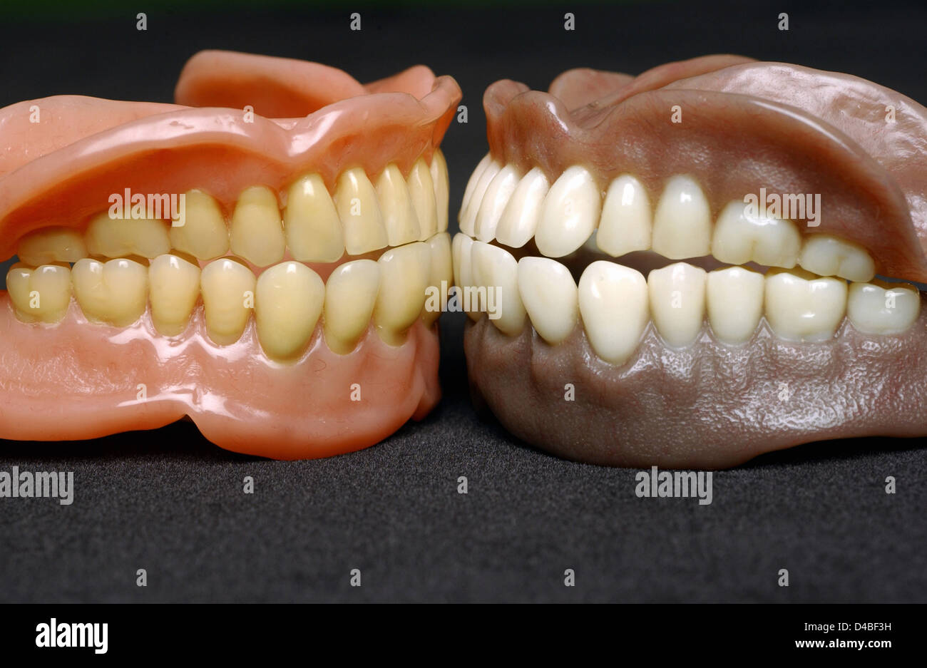 Dentures or false teeth made acrylic base on acrylic or ceramic teeth