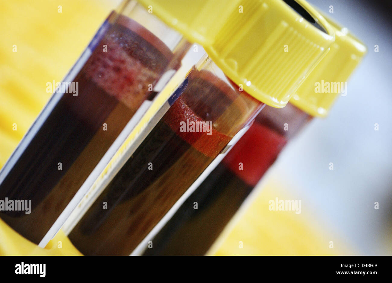 Samples of donated blood in Vacutainer test tubes with yellow tops