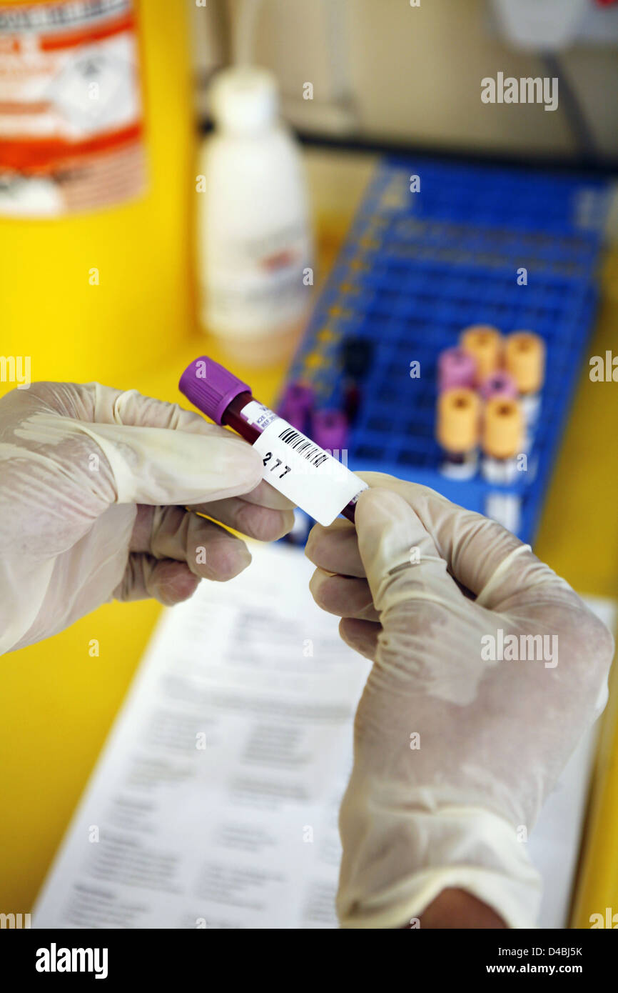 Pathologist labeling blood samples in test tube Stock Photo