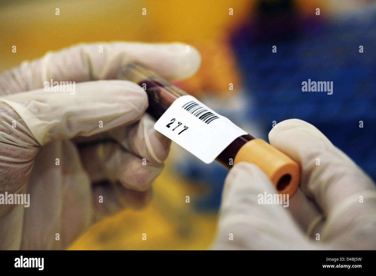 Pathologist labeling blood samples in test tube Stock Photo