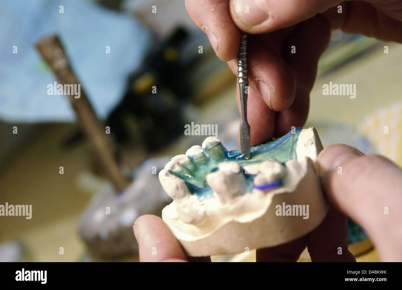 Preparation of dental cast with flux Stock Photo Alamy