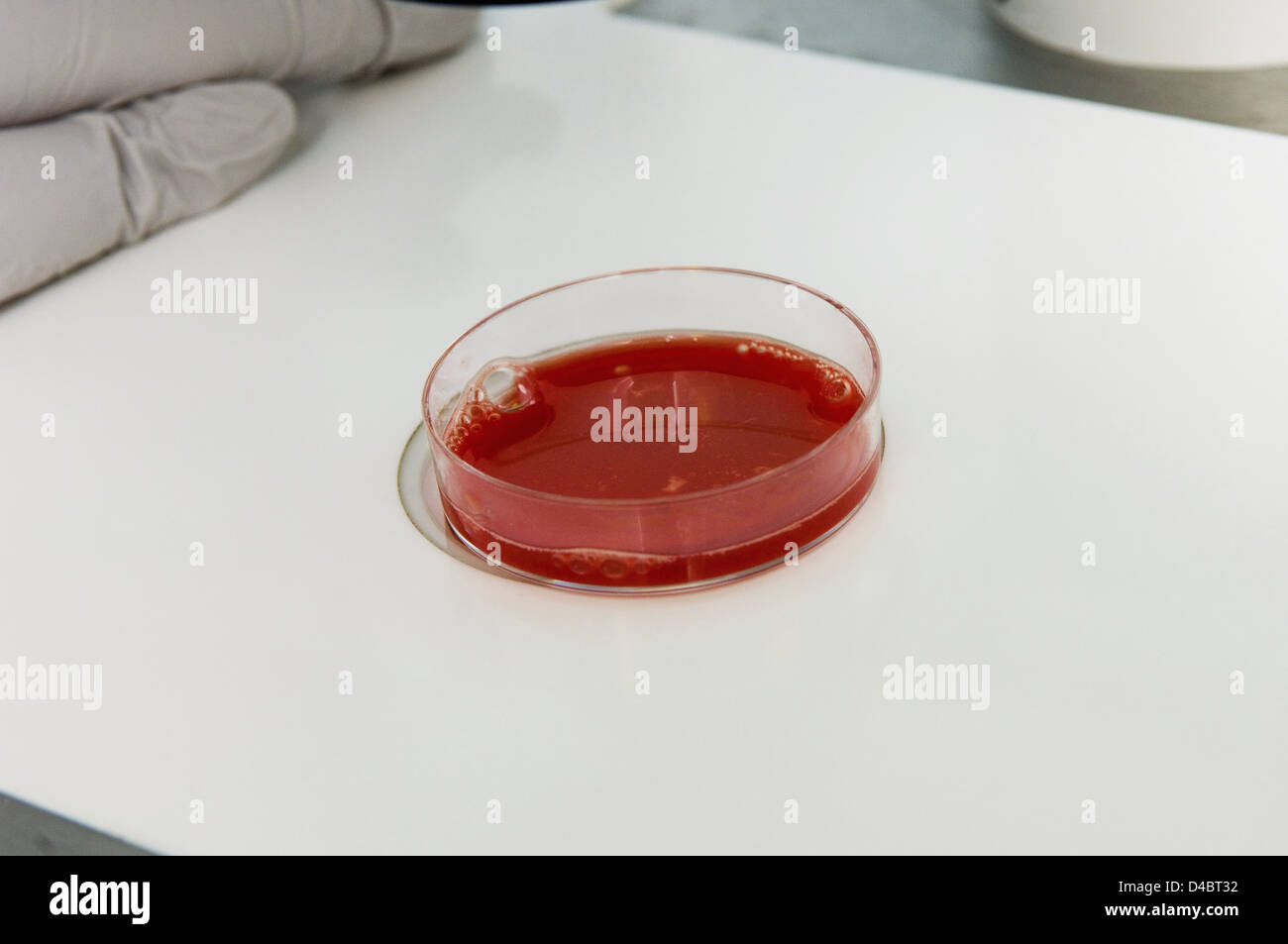 During surgery eggs collected female patient passed through lab. lab