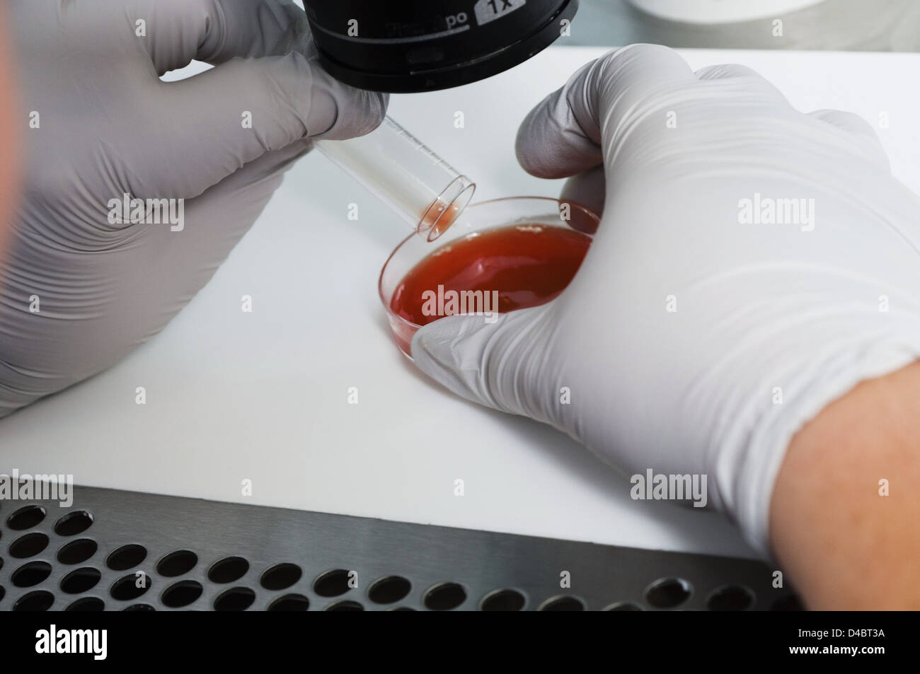 During surgery eggs collected female patient passed through lab. lab