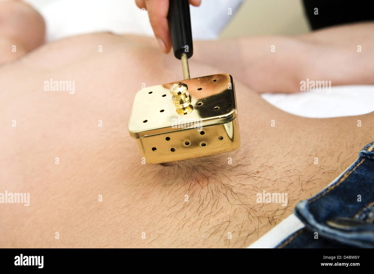 Moxibustion Oriental medicine technique in Chinese herb called mugwort or Artemesia Vulgaris used apply heat acupuncture point Stock Photo