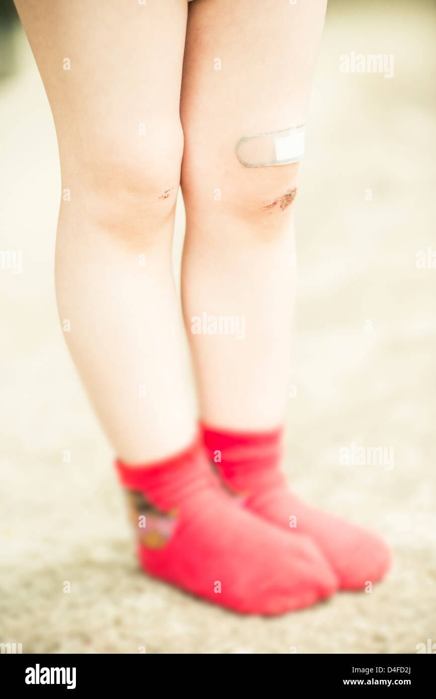 Girl 3 years old with red socks and scrape wound on her legs. Stock Photo