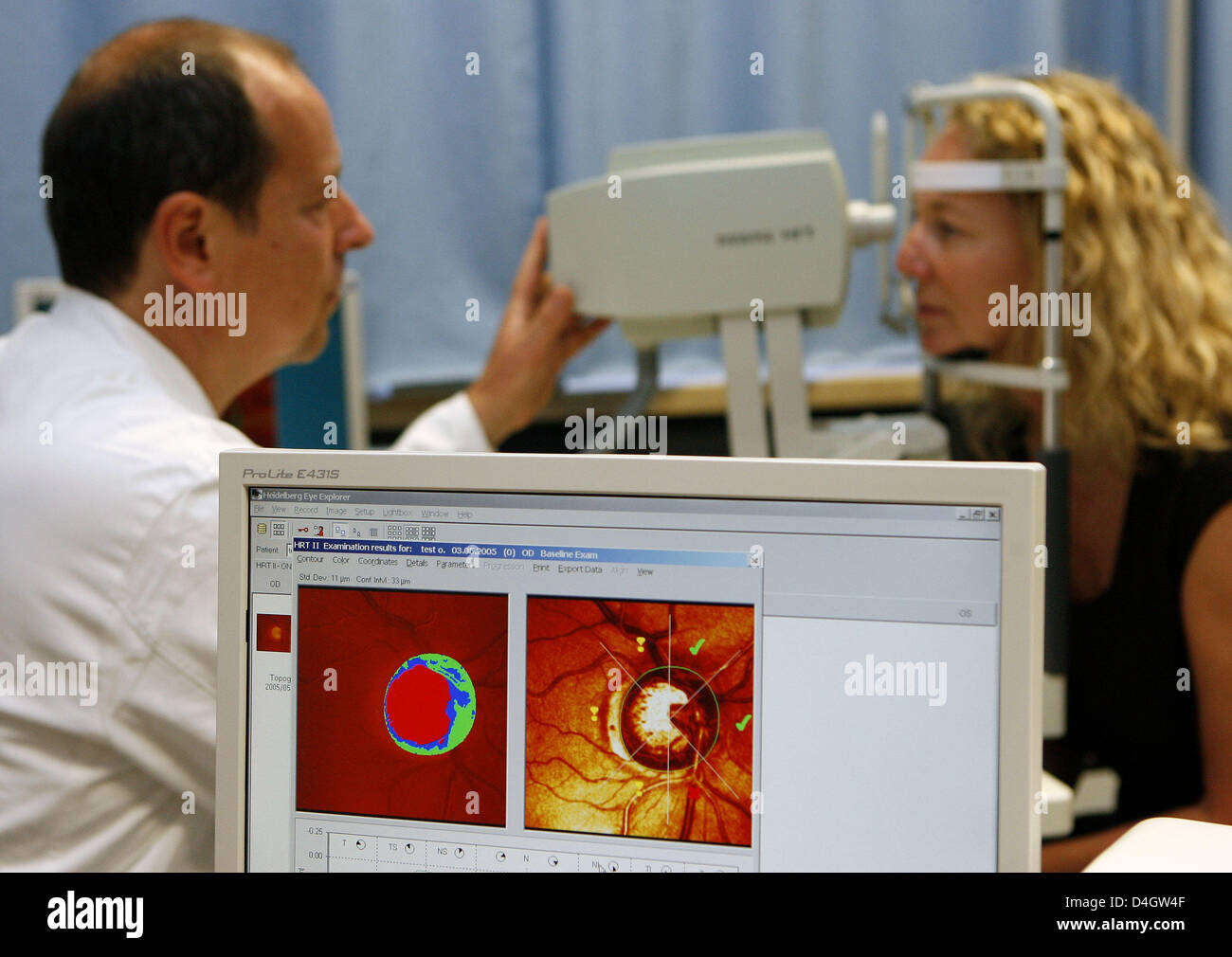 A woman is pictured during a computer analysis of the optic nerv within the scope of a glaucoma preventive examination carried out by a doctor of the university eye clinic in Erlangen, Germany, 26 June 2008. Glaucoma (also known as 'Green Star') is one of the major causes for loss of sight. Unnoticed by the patient the disease starts with the loss of the sensory cells of the optic  Stock Photo