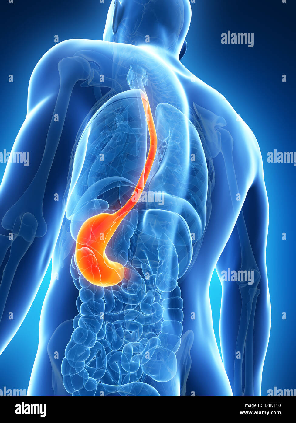 Stomach Ulcer Hi Res Stock Photography And Images Alamy