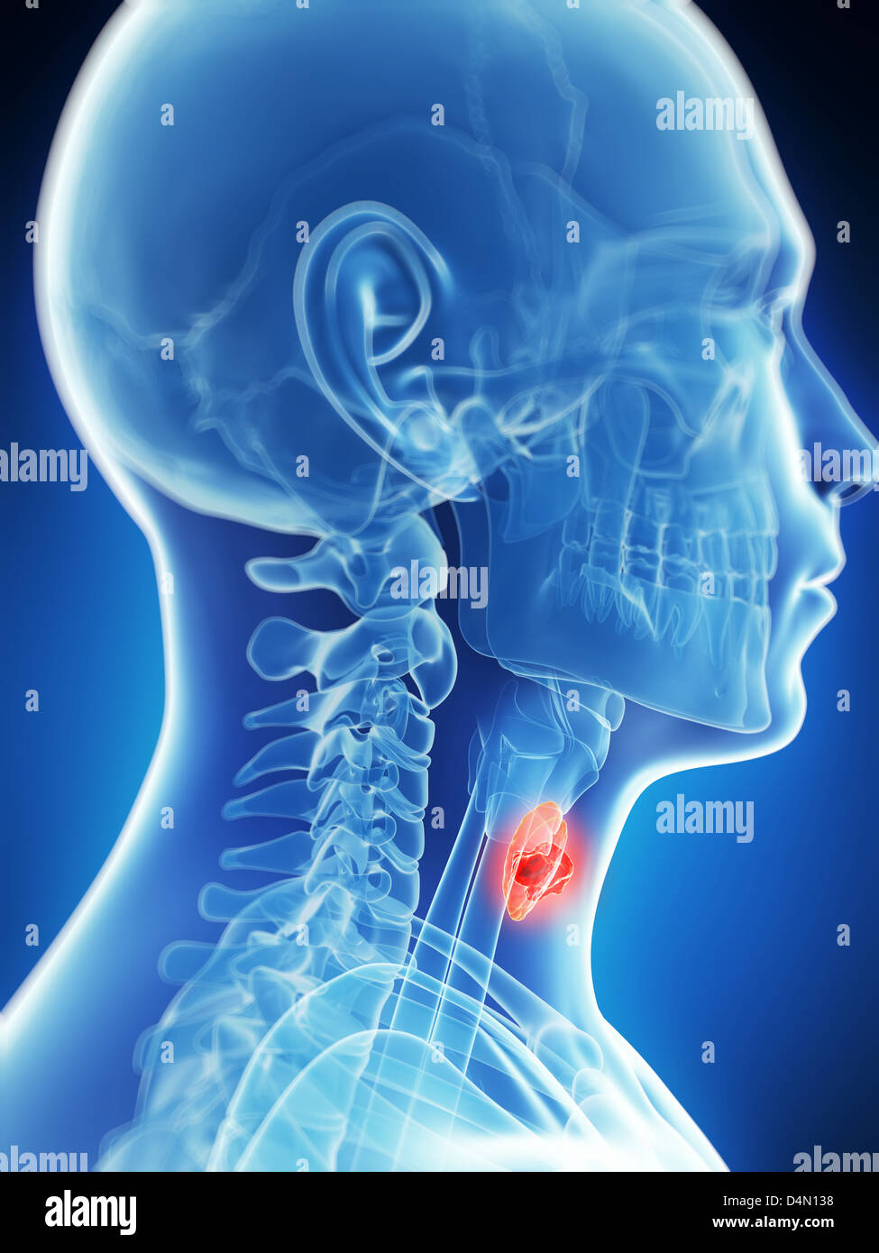 Thyroid cancer hi-res stock photography and images - Alamy