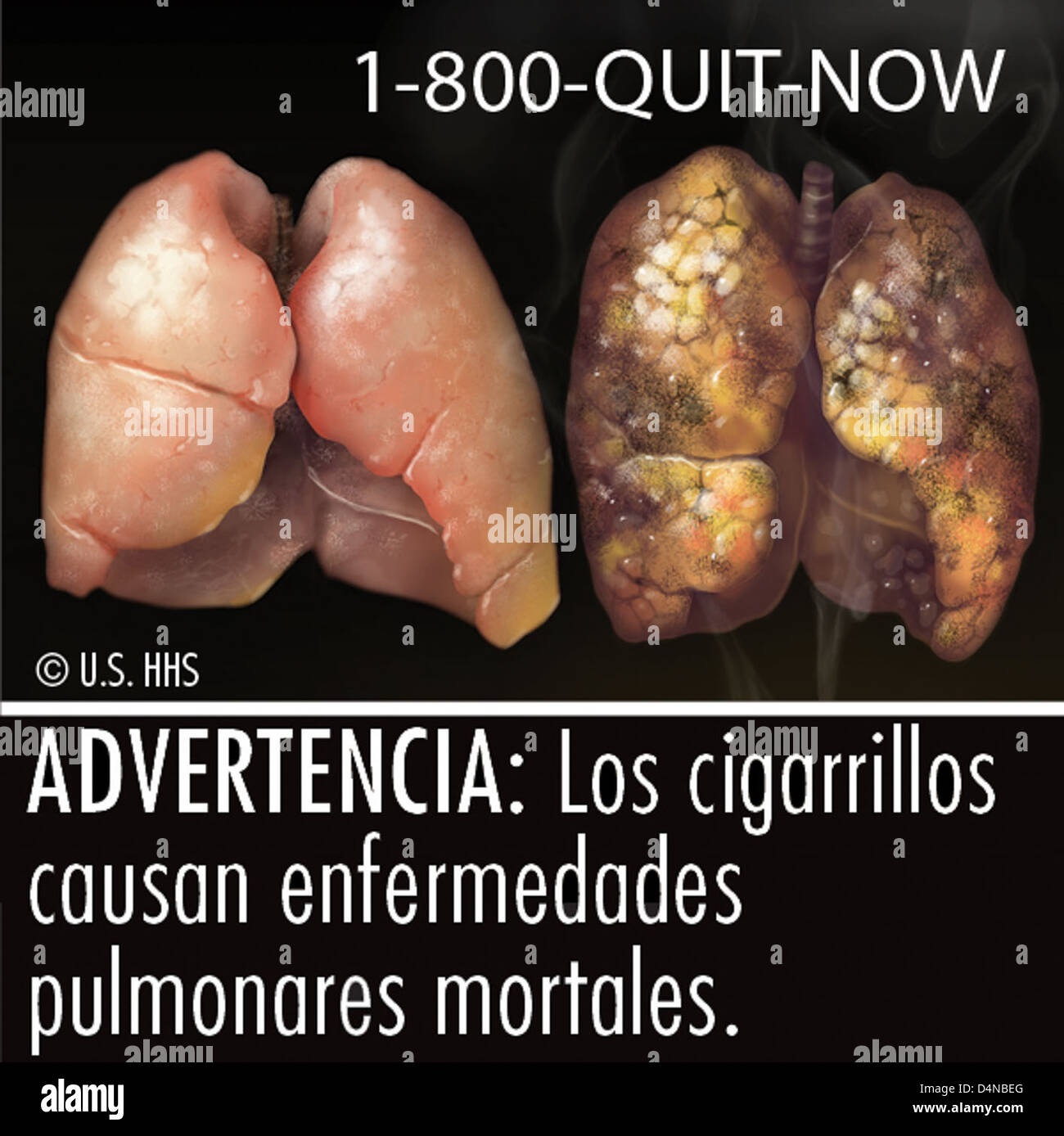 family tobacco control act The Family Smoking Prevention and Tobacco Control Act requires health  warning labels on cigarette packaging and advertisements, with graphics  depicting the health risks of smoking. This regulation aims to reduce  tobacco use