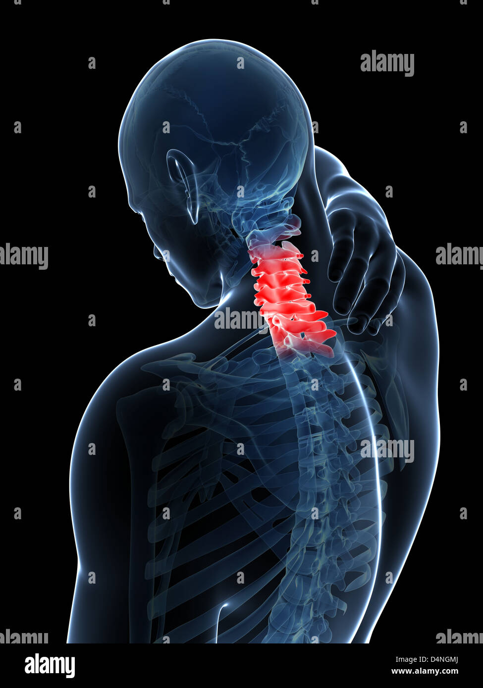 Он боль в шее. Он боль в шее. Он боль в шее. Двоение кожи. Он боль в шее.