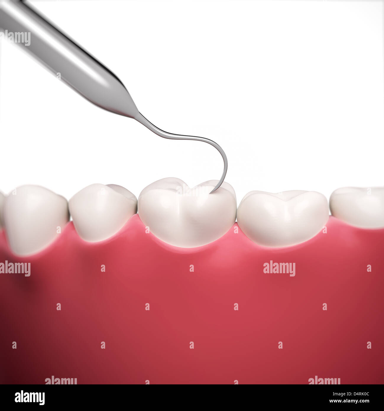 Wisdom tooth surgery hires stock photography and images Alamy