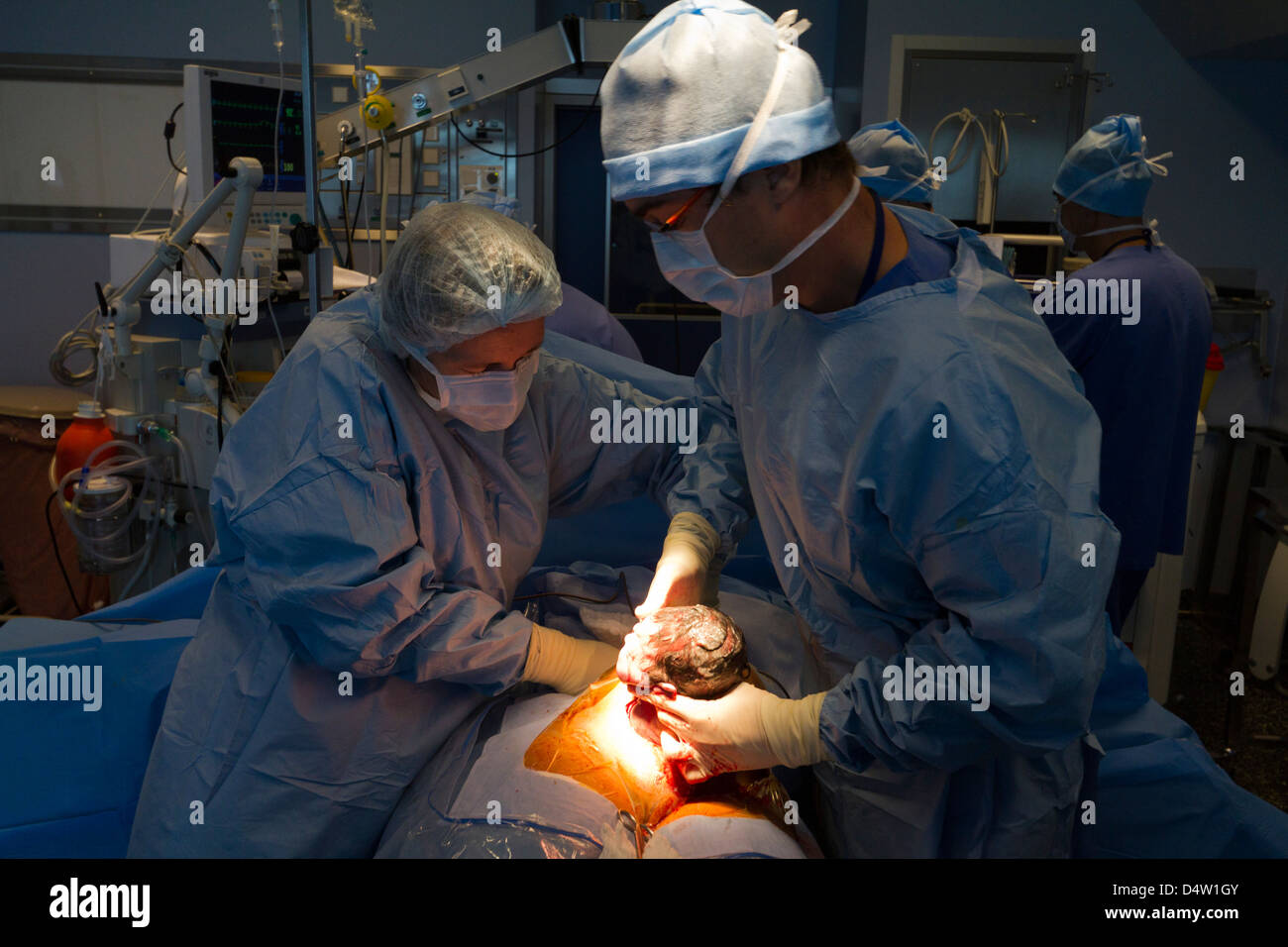 Cesarean in a hospital.a  newborn in  operating room Stock Photo