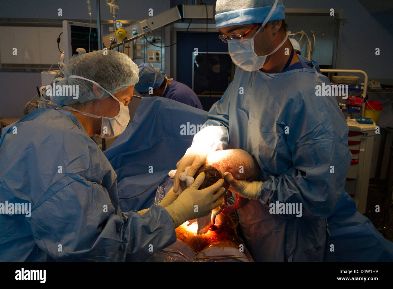 Caesarean in a hospital.a  newborn in  operating room Stock Photo
