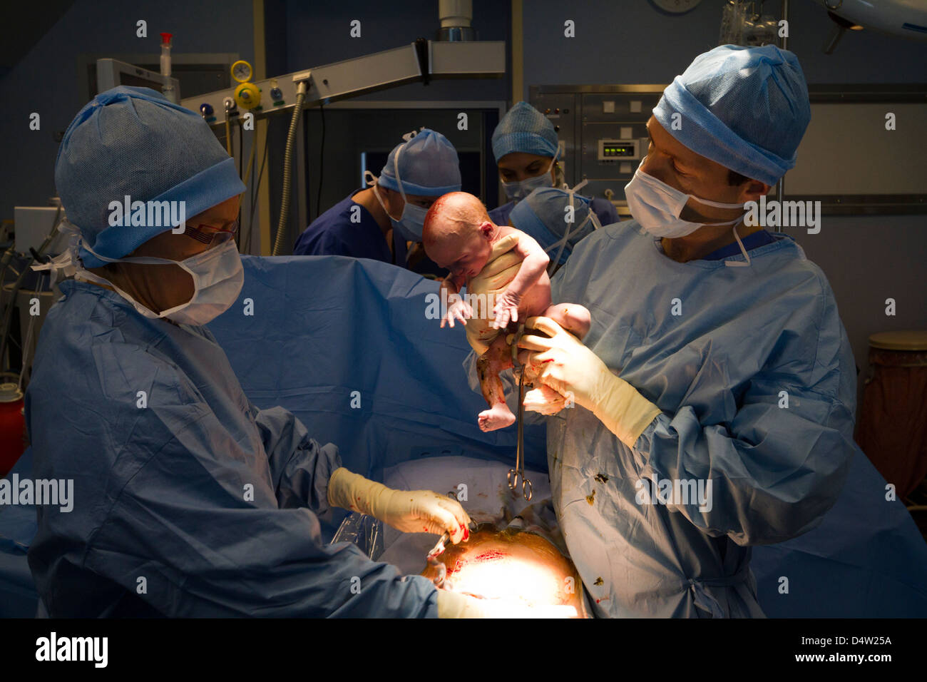 Cesarean in a hospital .a  newborn in  operating room Stock Photo
